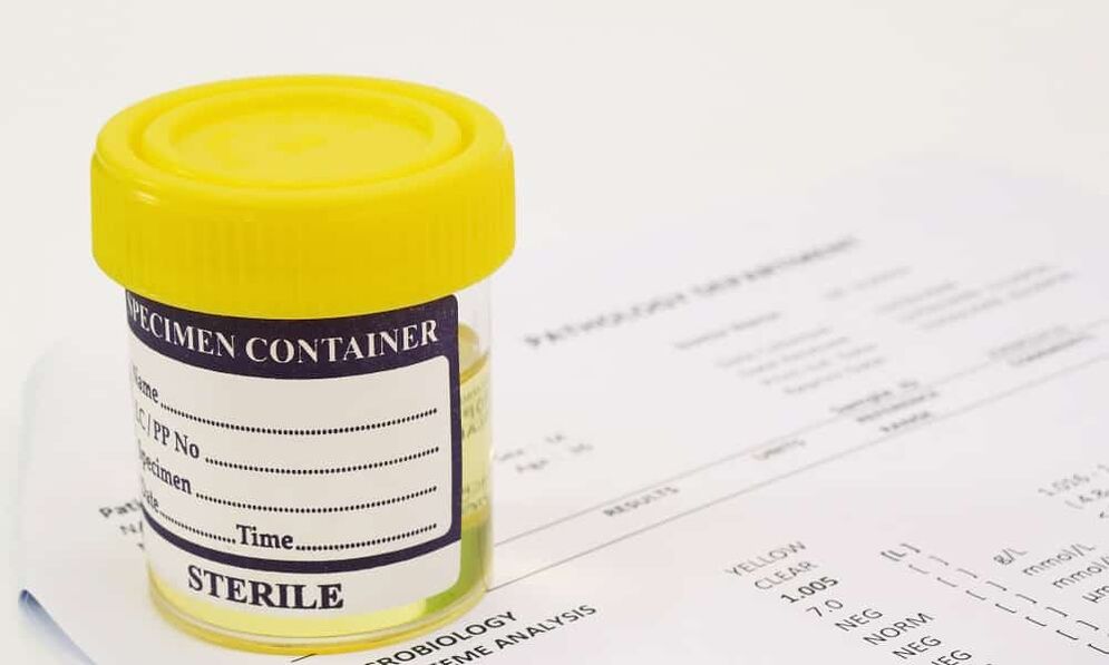 Voordat u antibiotica gebruikt, moet u een urinetest ondergaan